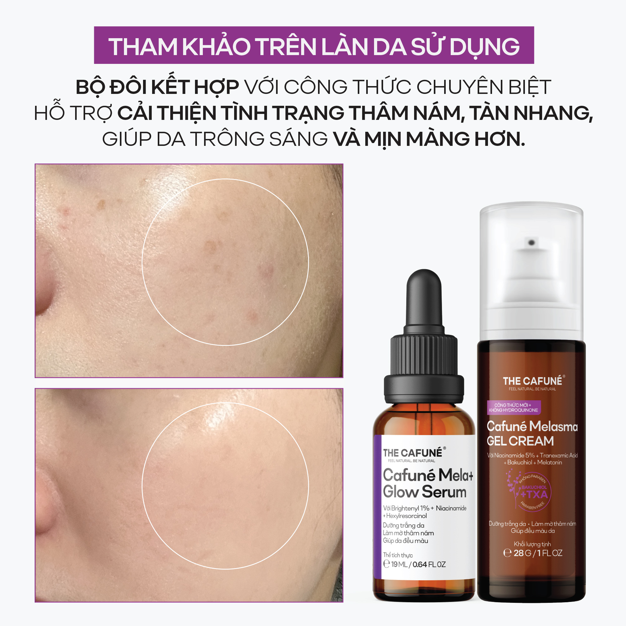Kem Làm Mờ Thâm Nám, Tàn Nhang Và Đều Màu Da Tối Ưu Cafuné Melasma Gel Cream, 28g